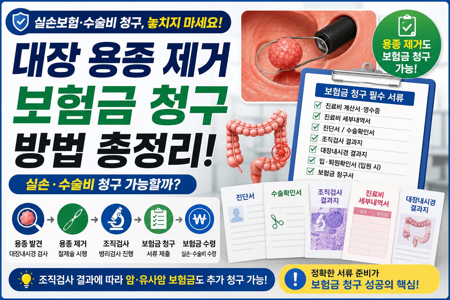 대장 용종 제거 보험금 청구 방법