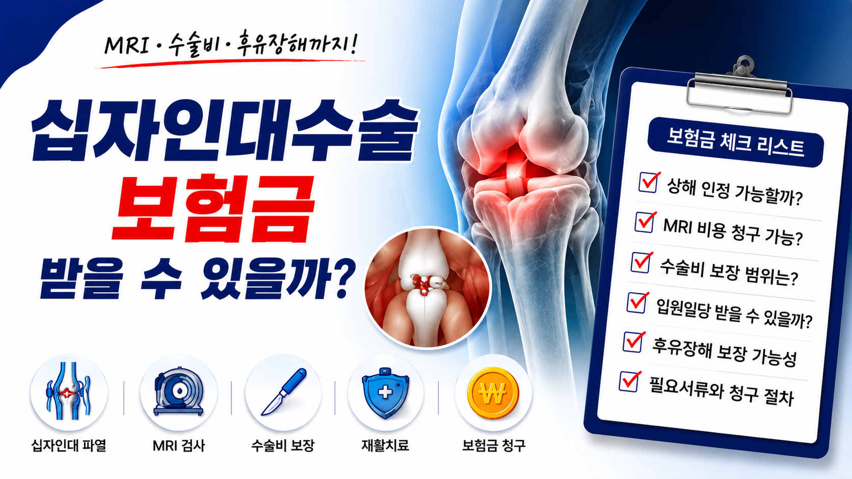 십자인대수술 보험금 받을 수 있을까?